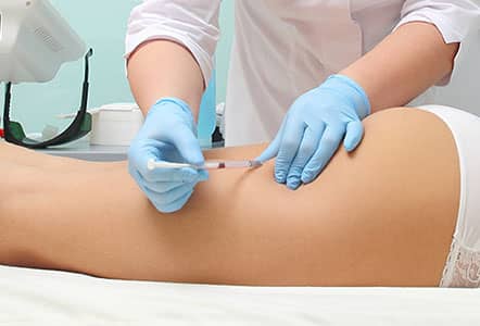 Stage 1 Injecting Aqualyx for Cellulite Breakdown