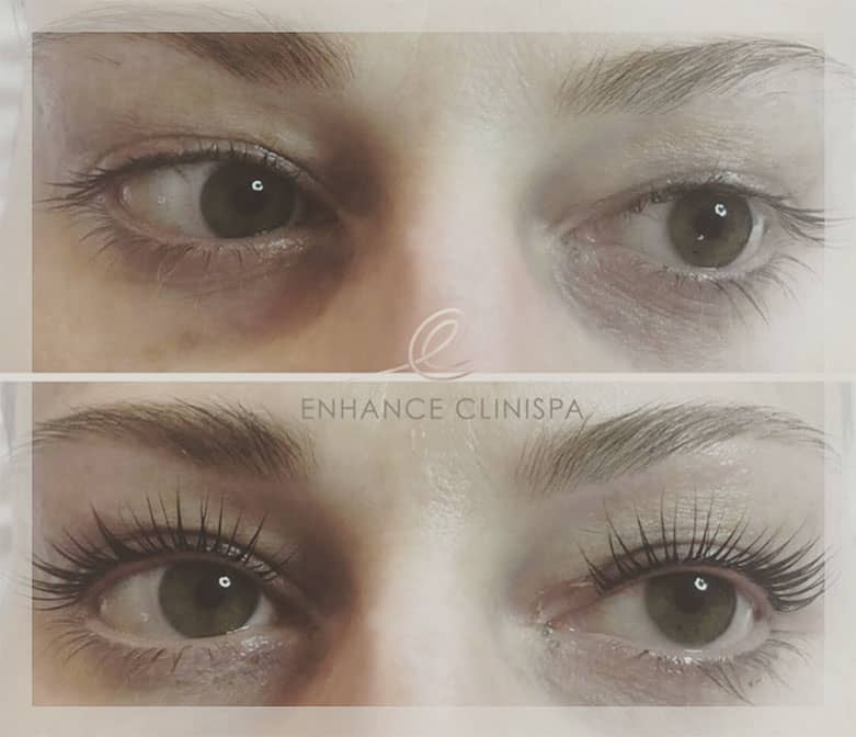 Before and After LVL Lash Lift