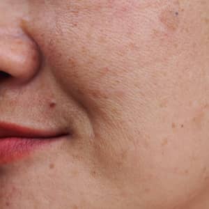 Anti-Ageing Skin Condition